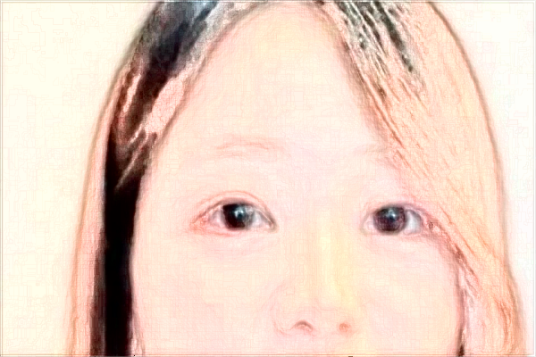 2024珠海市人民医院祛痣多少钱?祛痣挂什么科