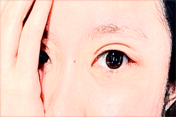 烟台毓璜顶医院热玛吉好吗?2024热玛吉收费价格