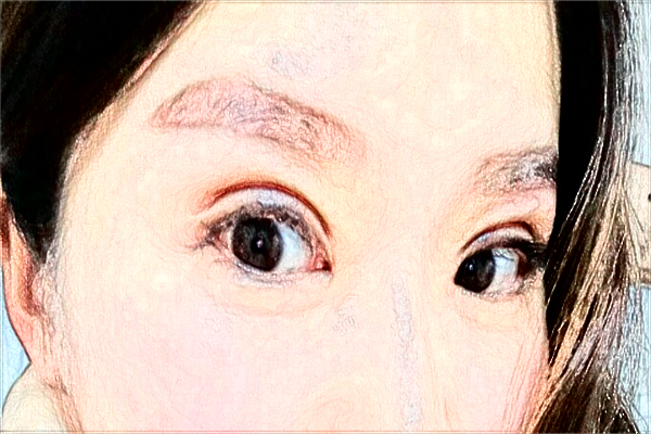 烟台毓璜顶医院热玛吉好吗?2024热玛吉收费价格