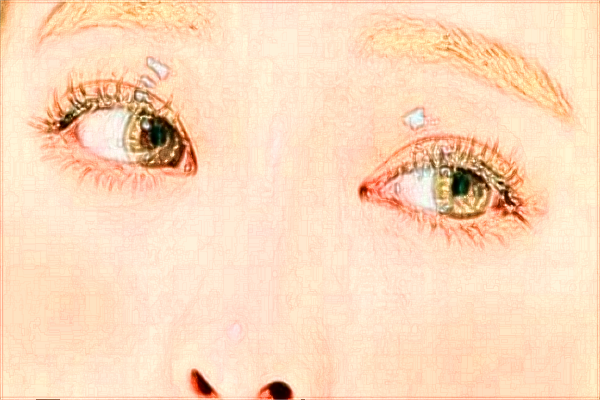 烟台毓璜顶医院隆鼻怎么样?假体隆鼻能保持几年?