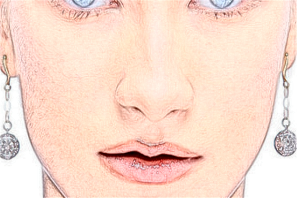 2024烟台毓璜顶医院祛斑多少钱?祛斑激光费用多少