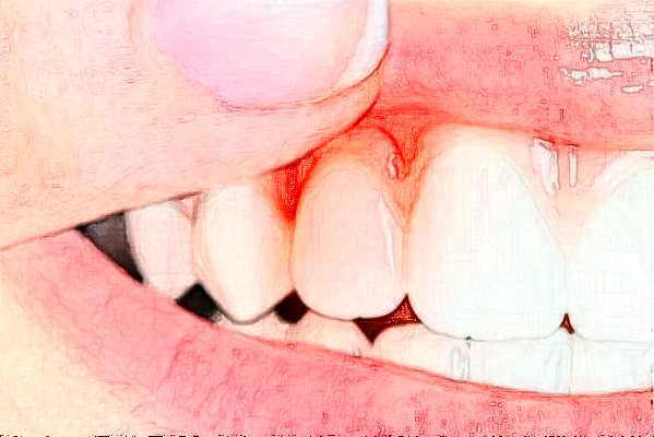 河北大学附属医院烤瓷牙好的大夫有谁?医生简介