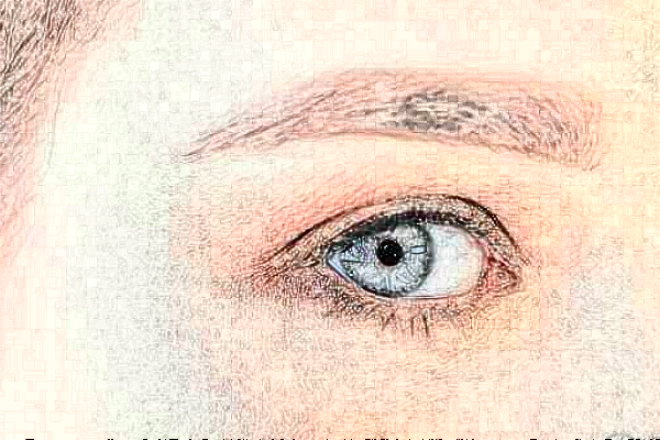 安徽医科大学第一附属医院半飞秒多少钱_医生名单推荐