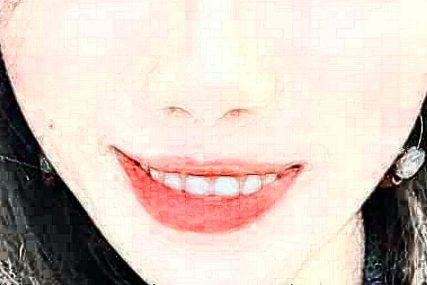 2024株洲市中心医院补牙多少钱?补牙材料是什么