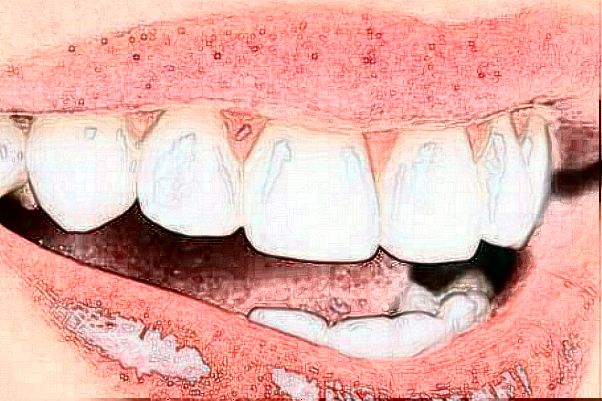2024齐齐哈尔市中医院牙齿种植怎么样_医生排名介绍
