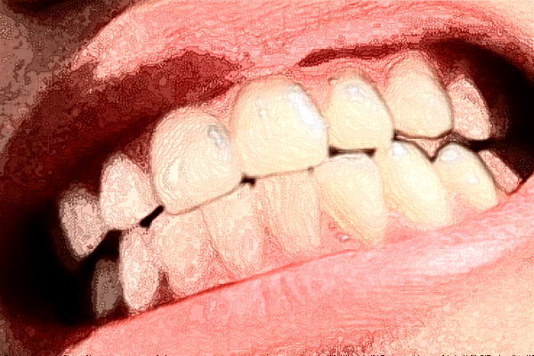 2022山西省人民医院牙齿修复怎么样|医生介绍|价格收费