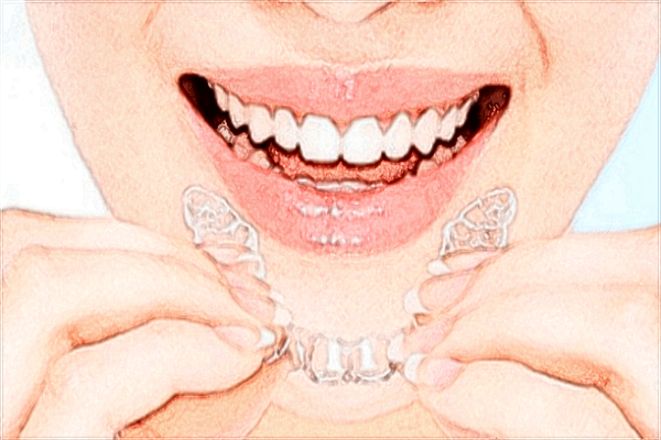 2024佛山市第二人民医院牙齿矫正费用?矫正牙齿好吗