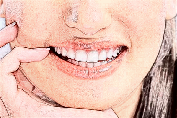 2024青岛市立医院根管牙齿价格?根管裂开了怎么办