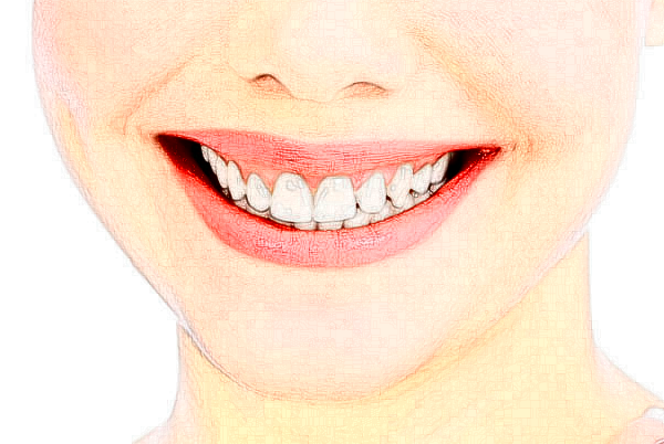 无锡市人民医院地包天矫正价位多少?专家介绍