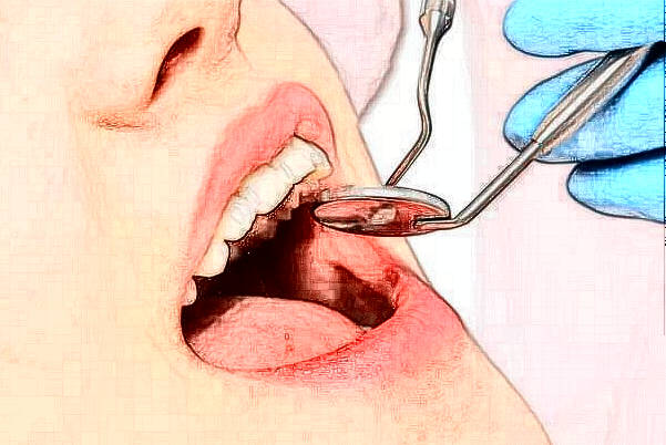 2024山西省人民医院义齿修复怎么样|医生介绍|价格收费