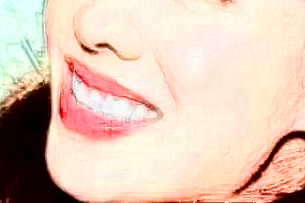 郑州植得口腔医院全瓷牙能用多久?2024全瓷牙价格