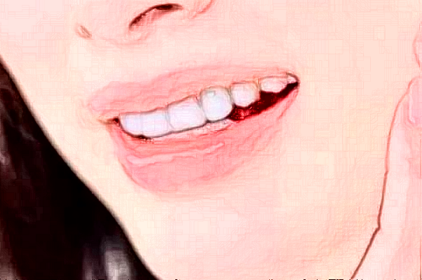 2024郑州植得口腔医院种牙多少钱?种牙好还是镶牙好