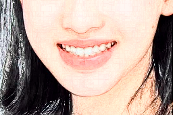 2024郑州植得口腔医院种牙多少钱?种牙好还是镶牙好