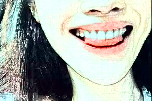 自贡华医口腔医院洗牙怎么样?洗牙结石多少钱一次?