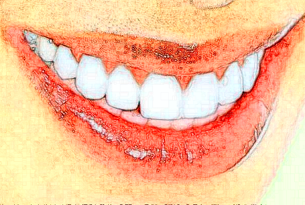 辽宁省人民医院根管费用多少?整形日记全过程