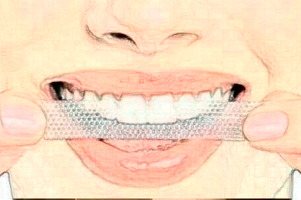 长沙科尔雅口腔医院全口种植怎么样|医生介绍|价格收费