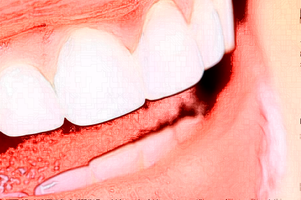 赣州贝壳口腔隐形矫正怎么样，附医生信息一览~