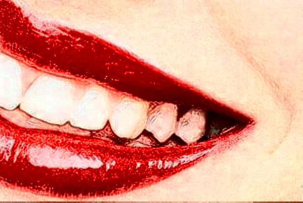 成都茁悦口腔正畸做的好吗?哪位医生做得好