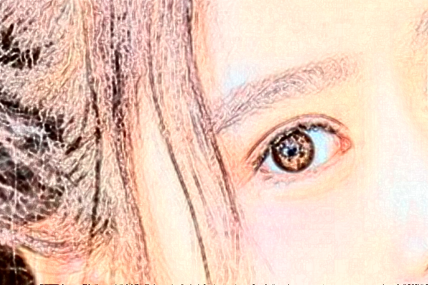 铜陵市人民医院全飞秒怎么样_医生案例_评价