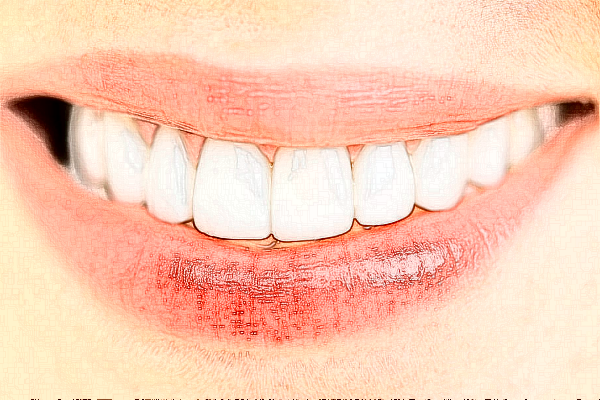 2024中山香山口腔医院补牙价格?补牙哪个医生好?