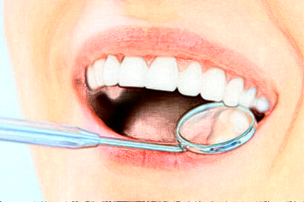 福州福能海峡口腔医院冷光美白多少钱_案例反馈