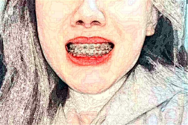 成都茁悦口腔根管做的好吗?哪位医生做得好