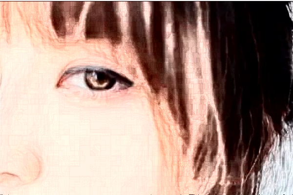 无锡市人民医院全飞秒好吗?附价格表+案例