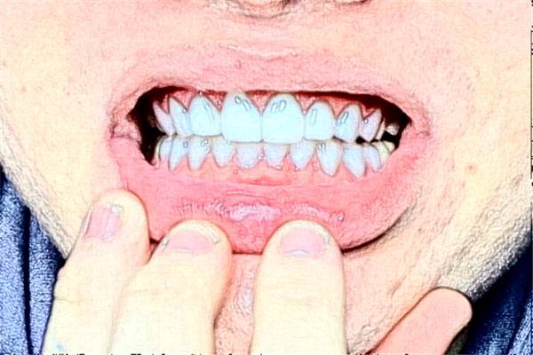 2024太原众牙口腔医院补牙多少钱?做的怎么样