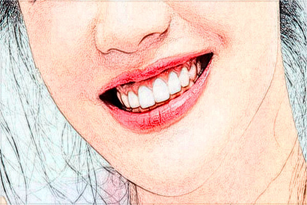 成都新桥口腔医院种植牙医生介绍?种植牙的寿命多久