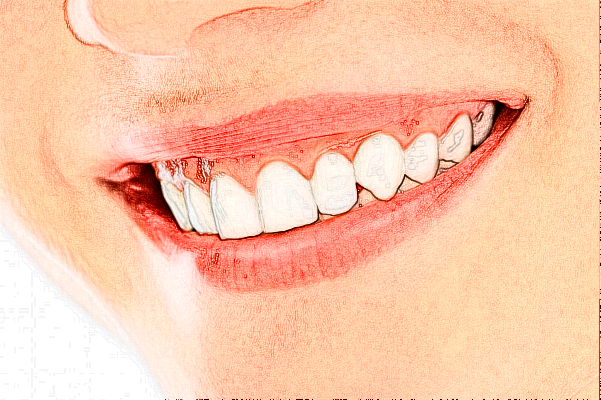 成都新桥口腔医院补牙怎么样费用高吗?补牙疼吗