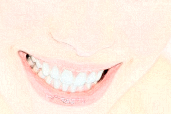 2024成都茁悦口腔拔牙好吗_真实案例发布