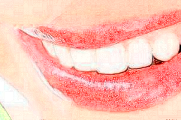 山东铂尔口腔种植牙做的好吗?案例欣赏+医生名单!