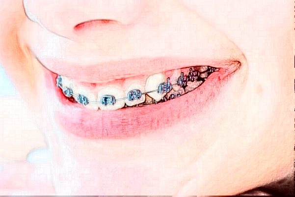 2024山东铂尔口腔全口种植哪个医生好?专家名单+案例反馈