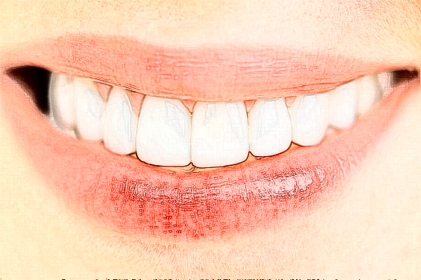 宣城大医医院种植牙的特点?种植牙的种植体系