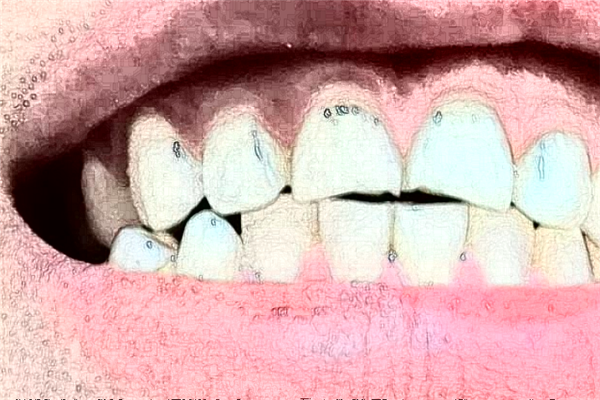 长沙好大夫口腔医院牙齿修复多少钱?做的怎么样