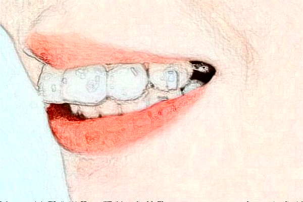 成都圣贝牙科医院拔牙好的医生推荐_美容日记展示