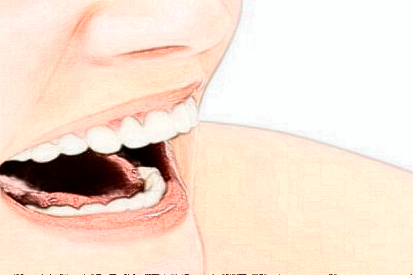 成都圣贝牙科医院拔牙好的医生推荐_美容日记展示