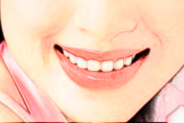 武汉德韩口腔医院种植牙怎么样?种植牙能维持几年