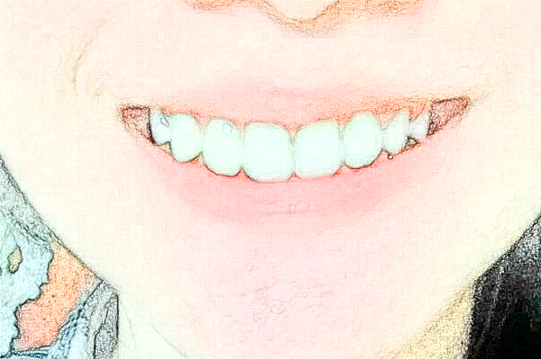 武汉德韩口腔医院种植牙怎么样?种植牙能维持几年