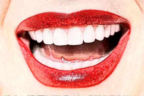 2024宣城大医医院金属托槽矫正价格?金属托槽矫正好吗