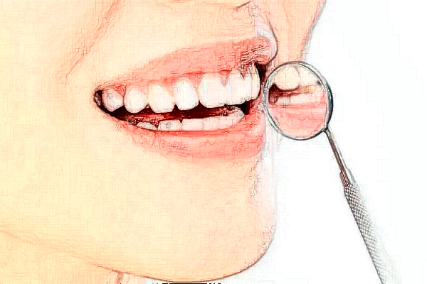 深圳乐莎莎口腔医院有哪些医生?矫正牙齿的医生案例