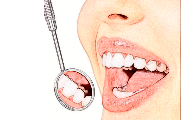 宣城大医医院全瓷牙能用多久?全瓷牙能维持多长时间