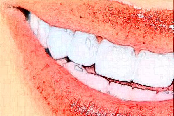 2024贵阳柏德口腔医院前牙种植费用多少?整形日记全过程