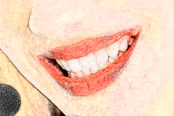 杭州雅莱口腔隐形矫正价目表(价格表)怎么样杭州雅莱口腔隐形矫正价目表(价格表)怎么样