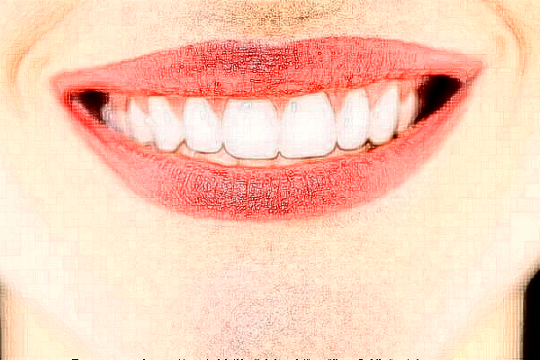 2024上海华美医疗美容医院种植一颗牙多少钱_做的怎么样