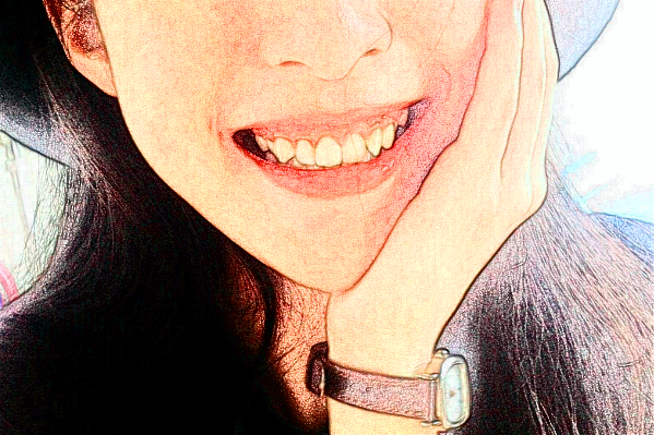 2024重庆团圆口腔医院隐形矫正费用?隐形矫正的优点