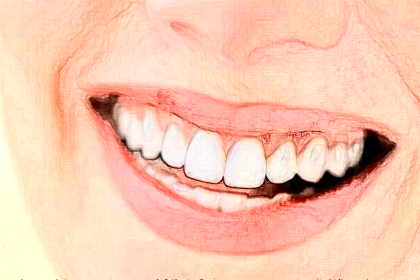 2024宣城大医医院牙齿矫正多少钱?牙齿矫正后遗症和危害