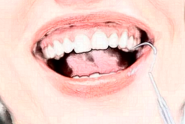 淮安诺贝尔口腔医院正畸怎么样?哪个医生好+价格