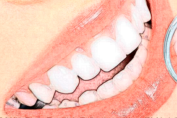 福州登特口腔医院全口种植好的大夫?医生简介