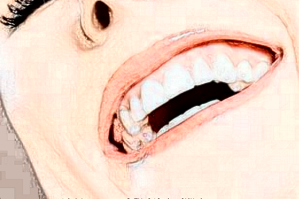 北京开颜口腔诊所种植牙怎么样|医生介绍|价格收费